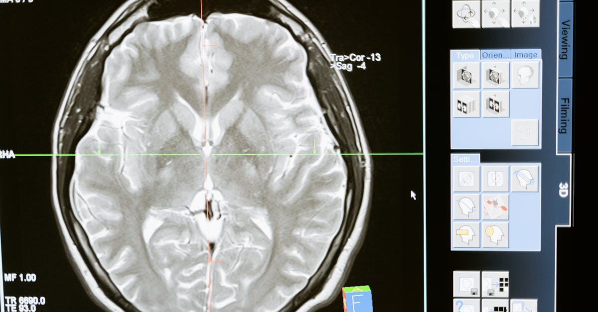 découvrez comment la stimulation cérébrale peut améliorer vos fonctions cognitives et favoriser la créativité. explorez les techniques innovantes qui transforment notre compréhension du cerveau.